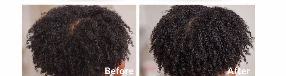 Hair growth oil